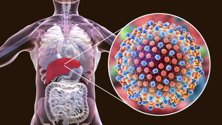 Hepatitis Explained