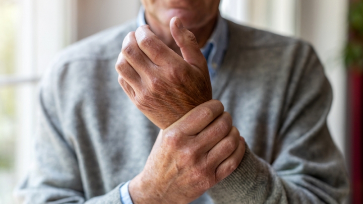 How to Manage Arthritis Pain